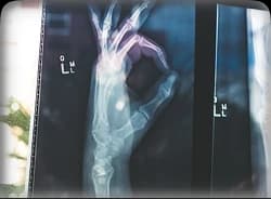 PREMIÈRES ACTIONS CONCRÈTES